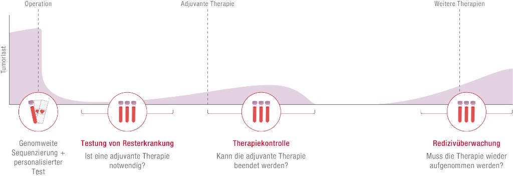 Wann HPH MRD einsetzen – Tumorlast, Operation, adjuvante Therapie, Rezidivüberwachung